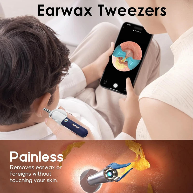 Bebird EarSight Plus Visual Earpick Ear Spoon Bendable & Affordable All-in-1 Ear Rod  with 6 LED Lights 1000W Camera Clean Ear